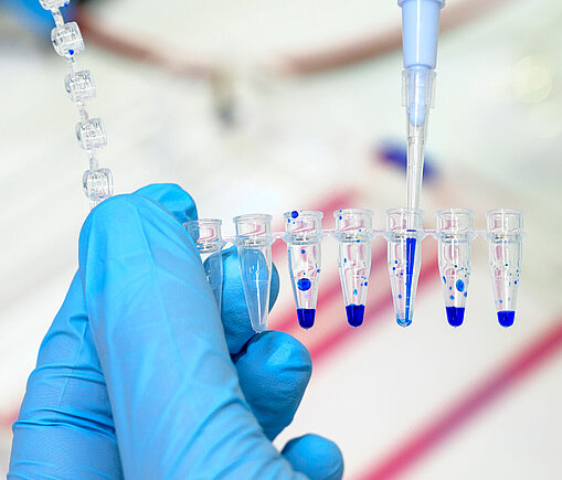 Gelelektrophorese im Bonner DZNE-Labor